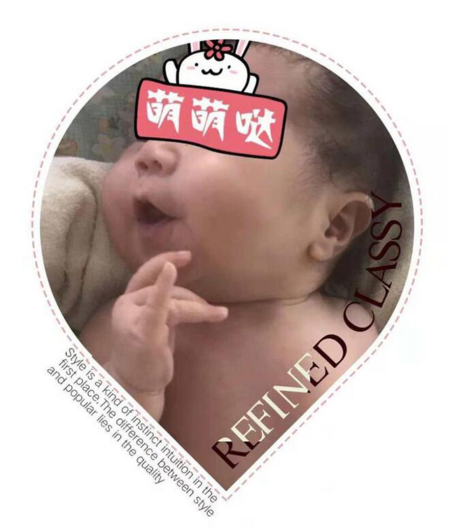 “小黄人”出院啦(图3)